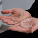 Clear Aligners Explained: Are They Right for You