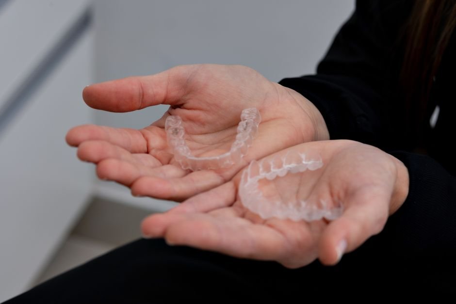 Clear Aligners Explained: Are They Right for You