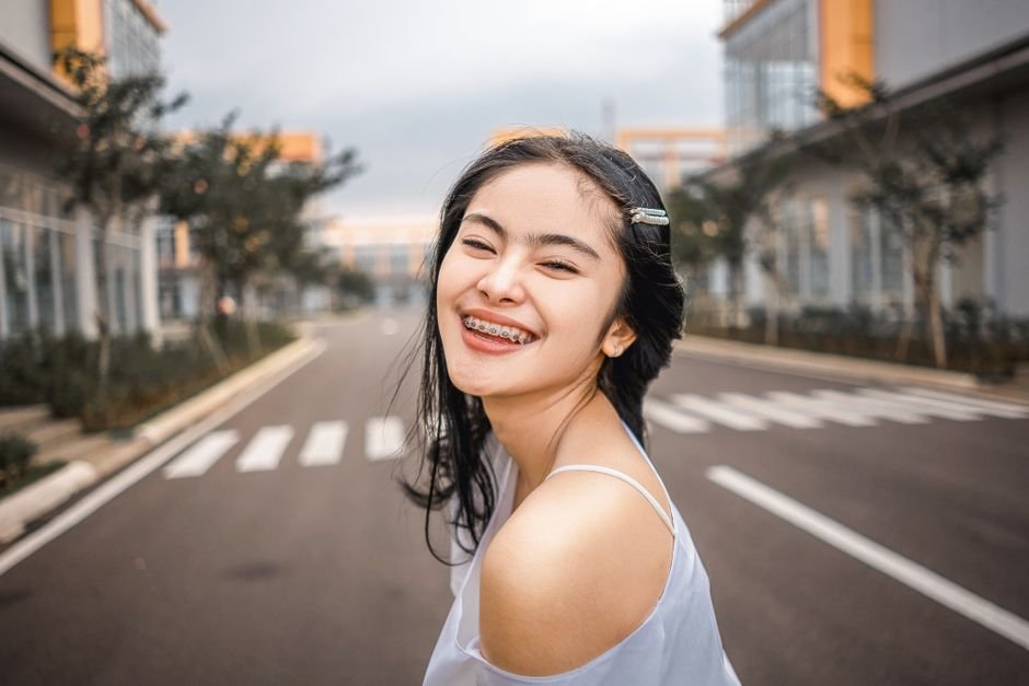 How Modern Braces Differ From Braces of the Past