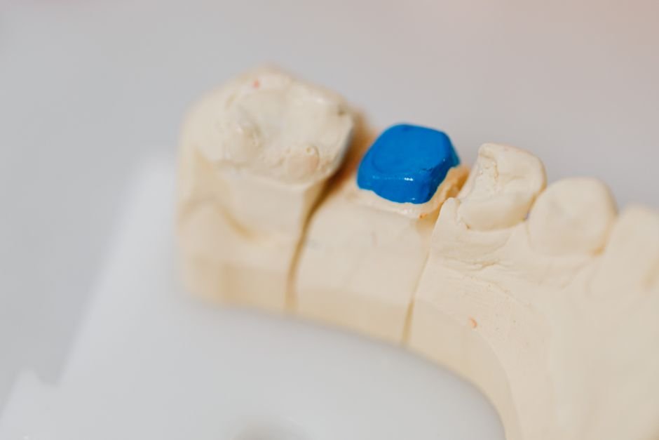 How Restorative Dentistry Restores Function, Not Just Looks