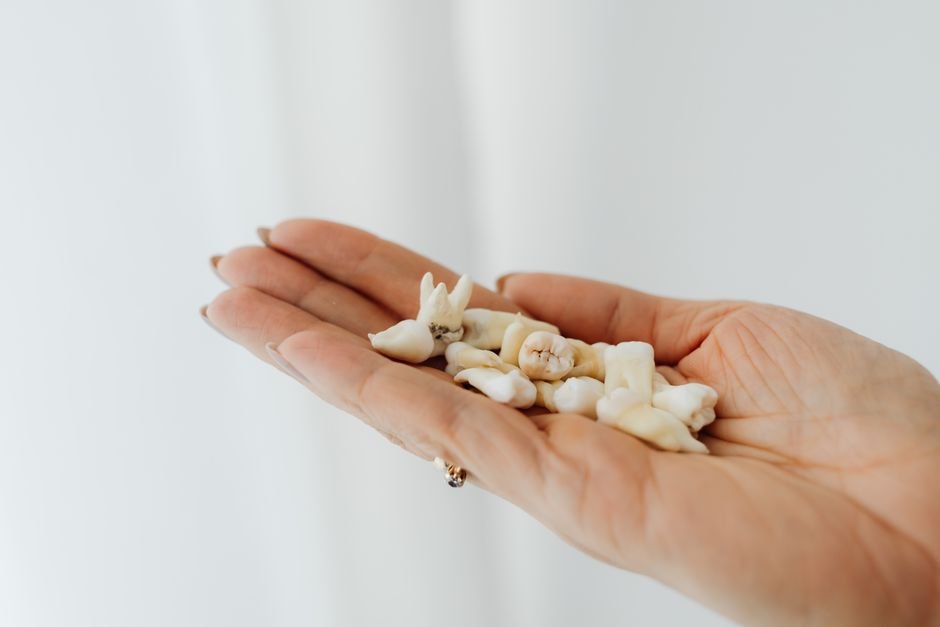 How Wisdom Teeth Growth Affects Your Bite