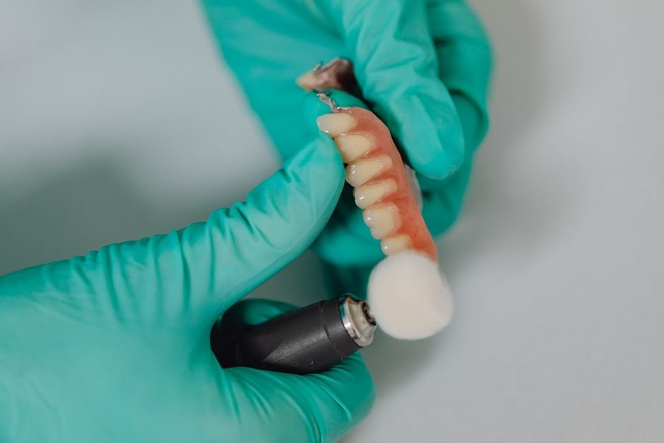 Same Day Dental Implants: How the Process Works