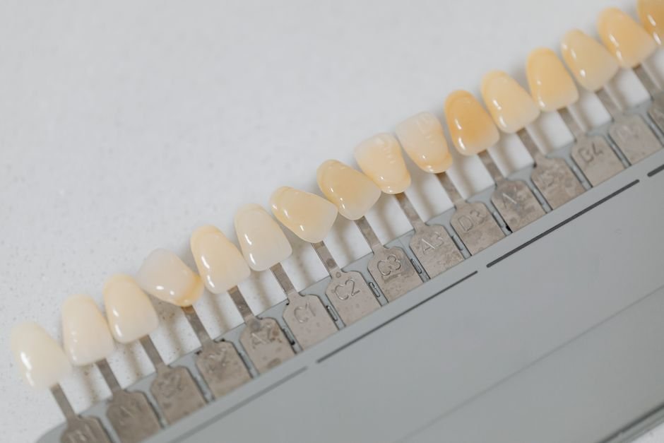 Teeth Whitening Explained: What Actually Works