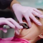 When a Tooth Extraction Becomes Necessary
