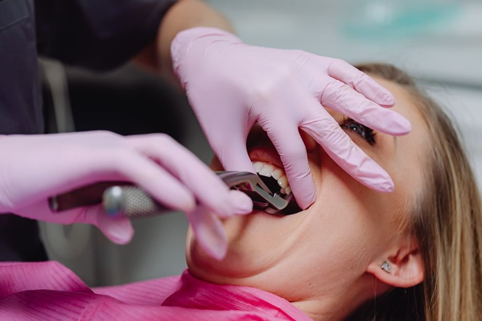 When a Tooth Extraction Becomes Necessary