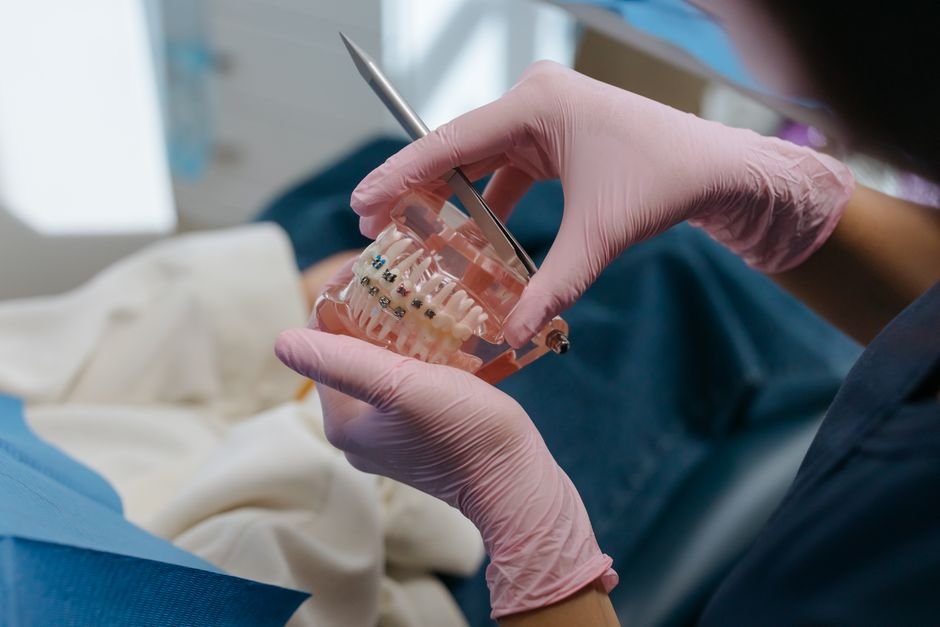 How Long Orthodontic Treatment Really Takes