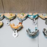 How Orthodontic Problems Develop Over Time