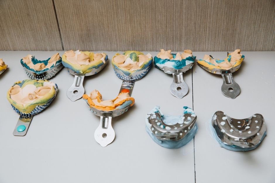 How Orthodontic Problems Develop Over Time