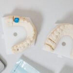 Understanding Dental Crown Materials and Durability