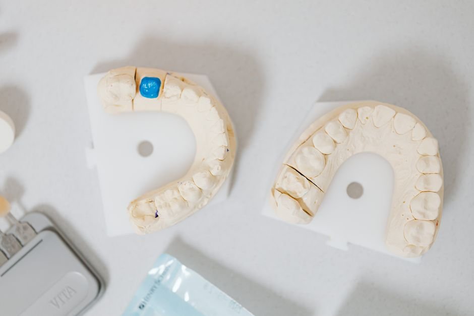 Understanding Dental Crown Materials and Durability