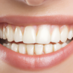 Cosmetic Dentistry Options for Chipped or Worn Teeth