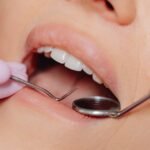 Understanding the Difference Between Plaque and Tartar