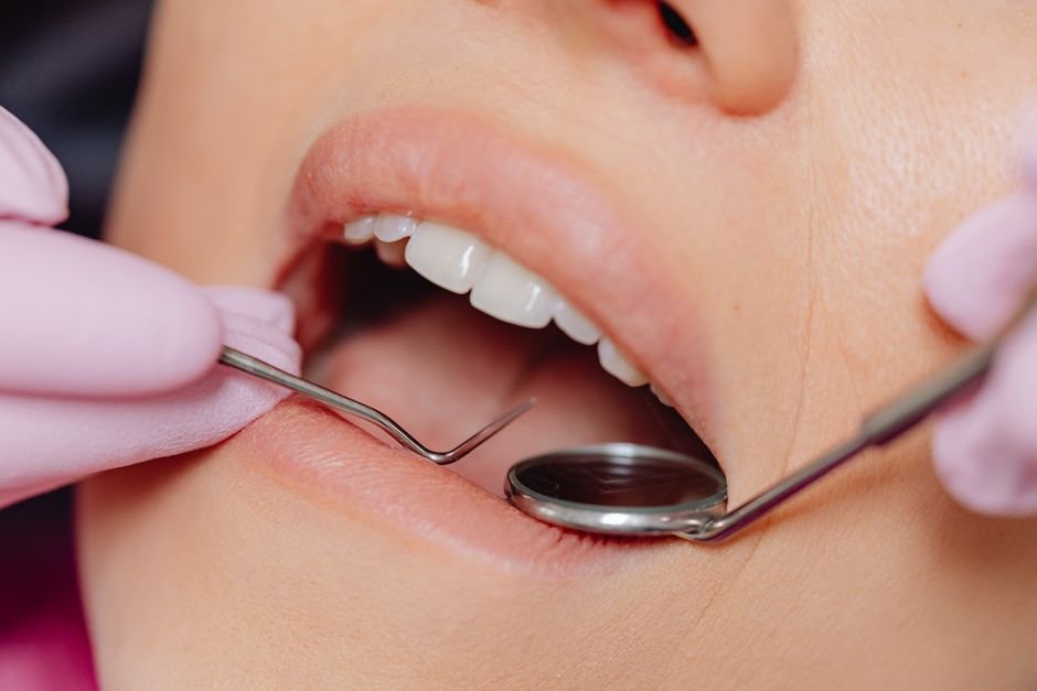 Understanding the Difference Between Plaque and Tartar