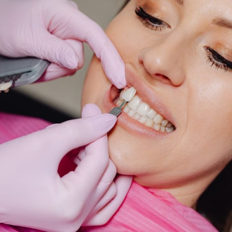 Caring for Cosmetic Dental Work Long Term