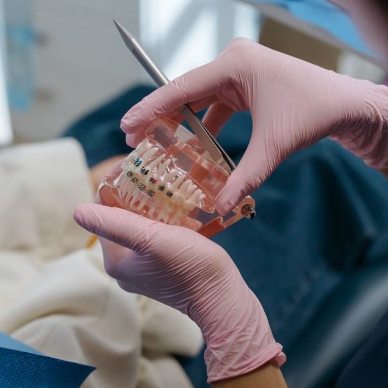 Common Orthodontic Myths Worth Debunking