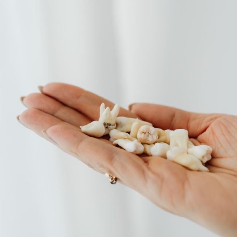How Wisdom Teeth Growth Affects Your Bite
