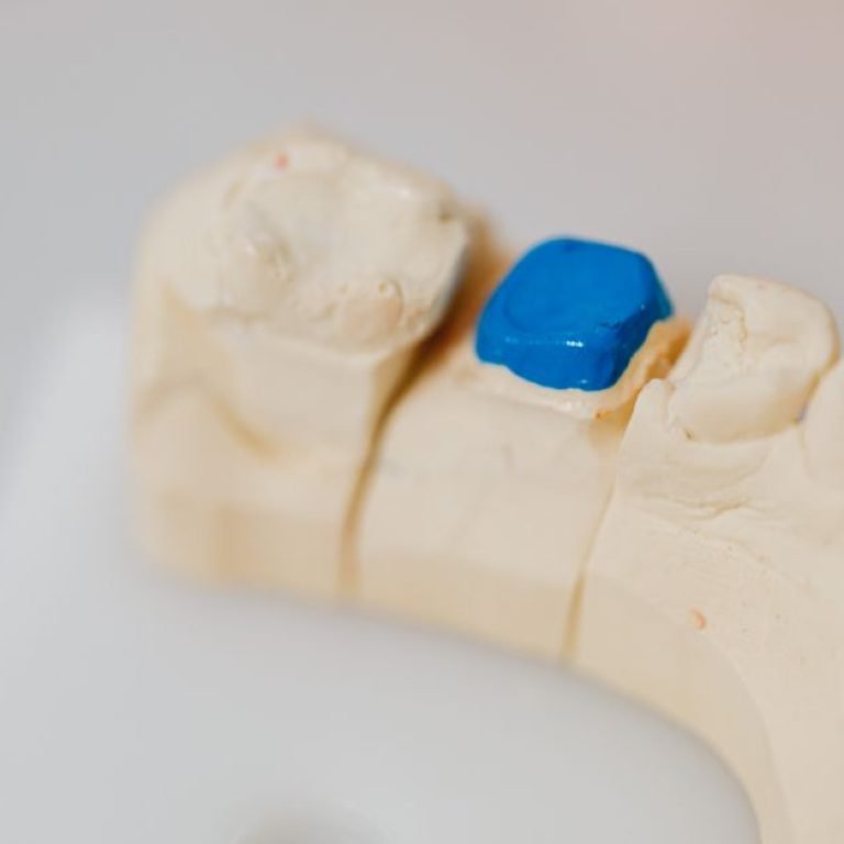 Restorative Dentistry for Severely Worn Teeth
