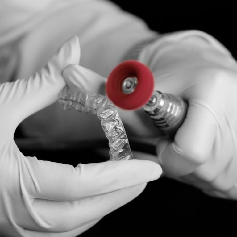 Retainers Explained: Why They Matter After Treatment