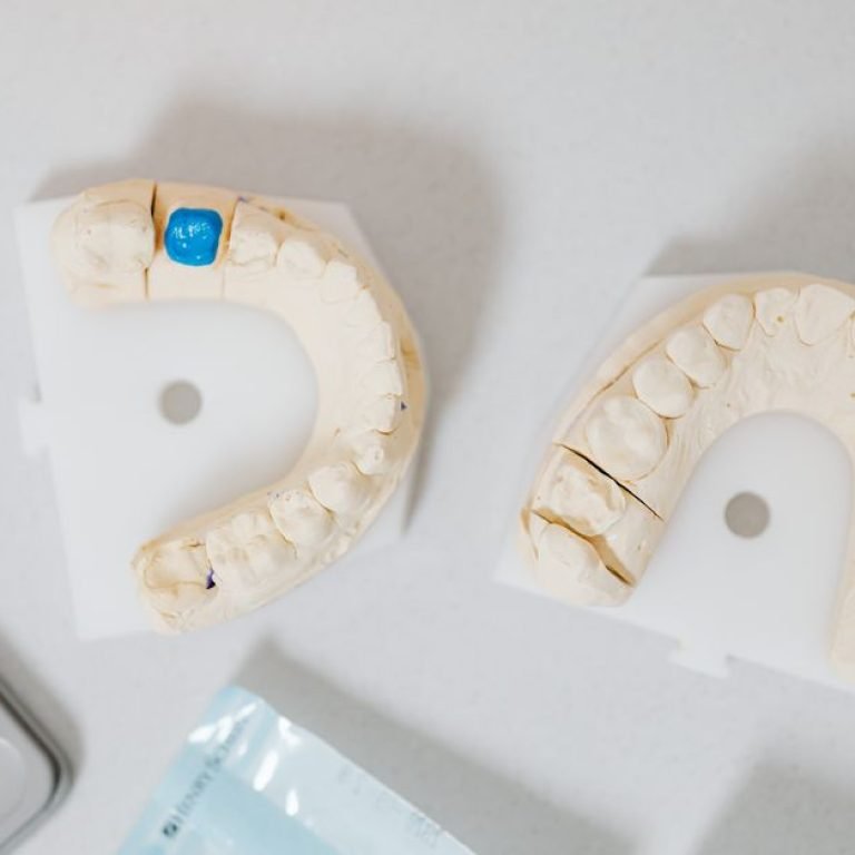 Understanding Dental Crown Materials and Durability