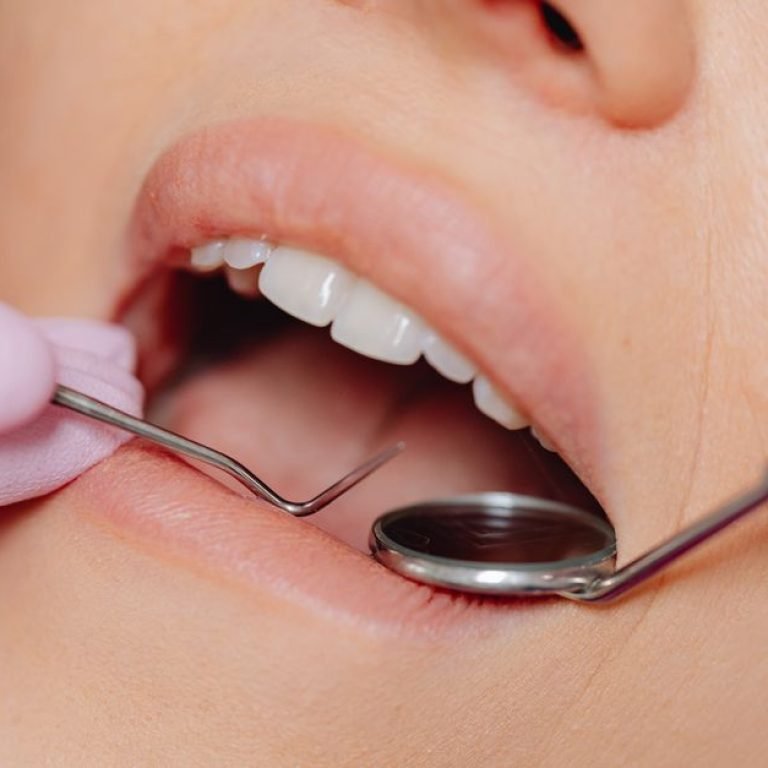 Understanding the Difference Between Plaque and Tartar